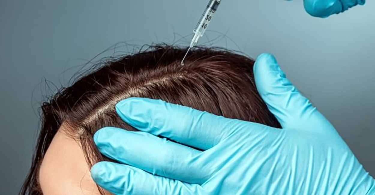 Platelet Rich Plasma (PRP)