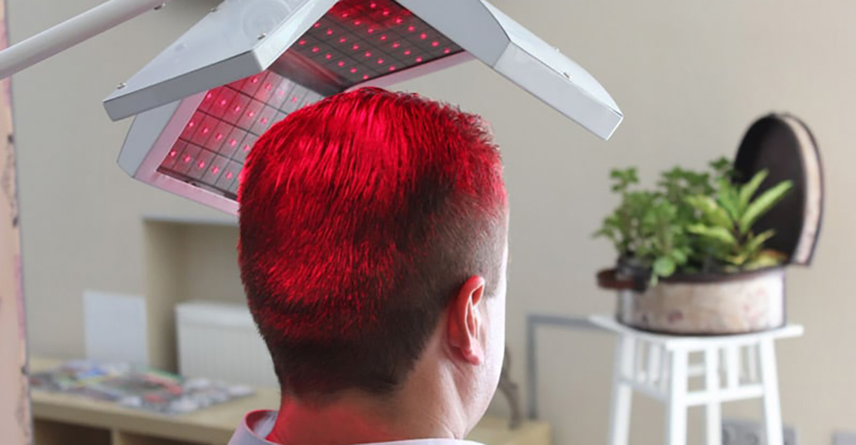 Low Level Laser Therapy for Hair Growth