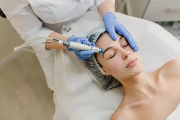 CO2 Fractional Laser for Acne Scars